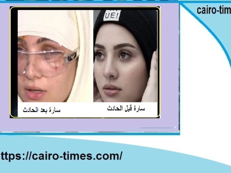 سارة محمد بعد فقدها بصرها ماذا يدور في الكواليس بالفيديو وسبب تعرضها للسرقة
