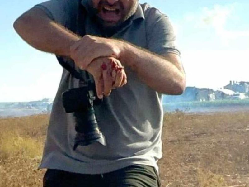 إصابة المصور “أشرف أبو عمرة” وبتر ثلاث اصابع من يده
